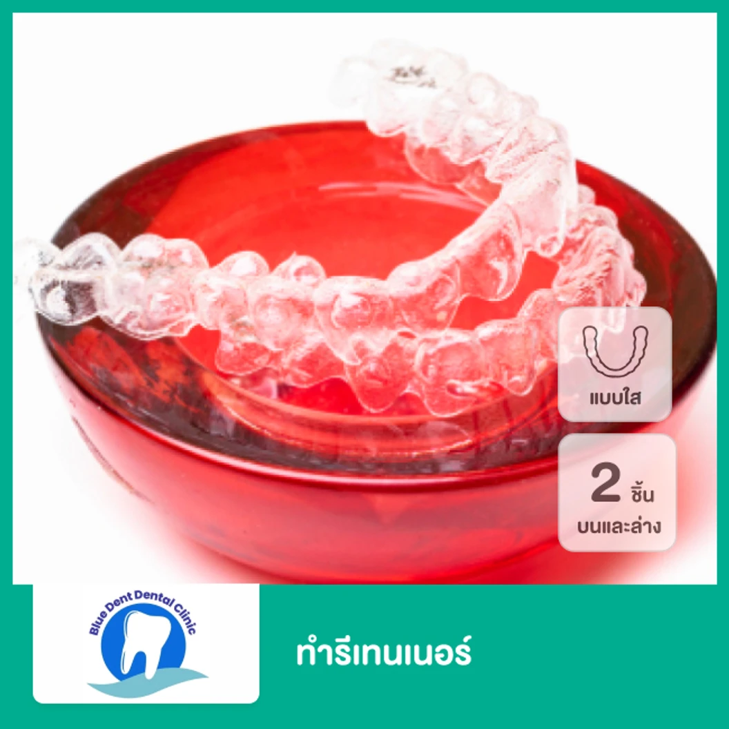 ทำรีเทนเนอร์แบบใส 2 ชิ้น ฟันบนและล่าง