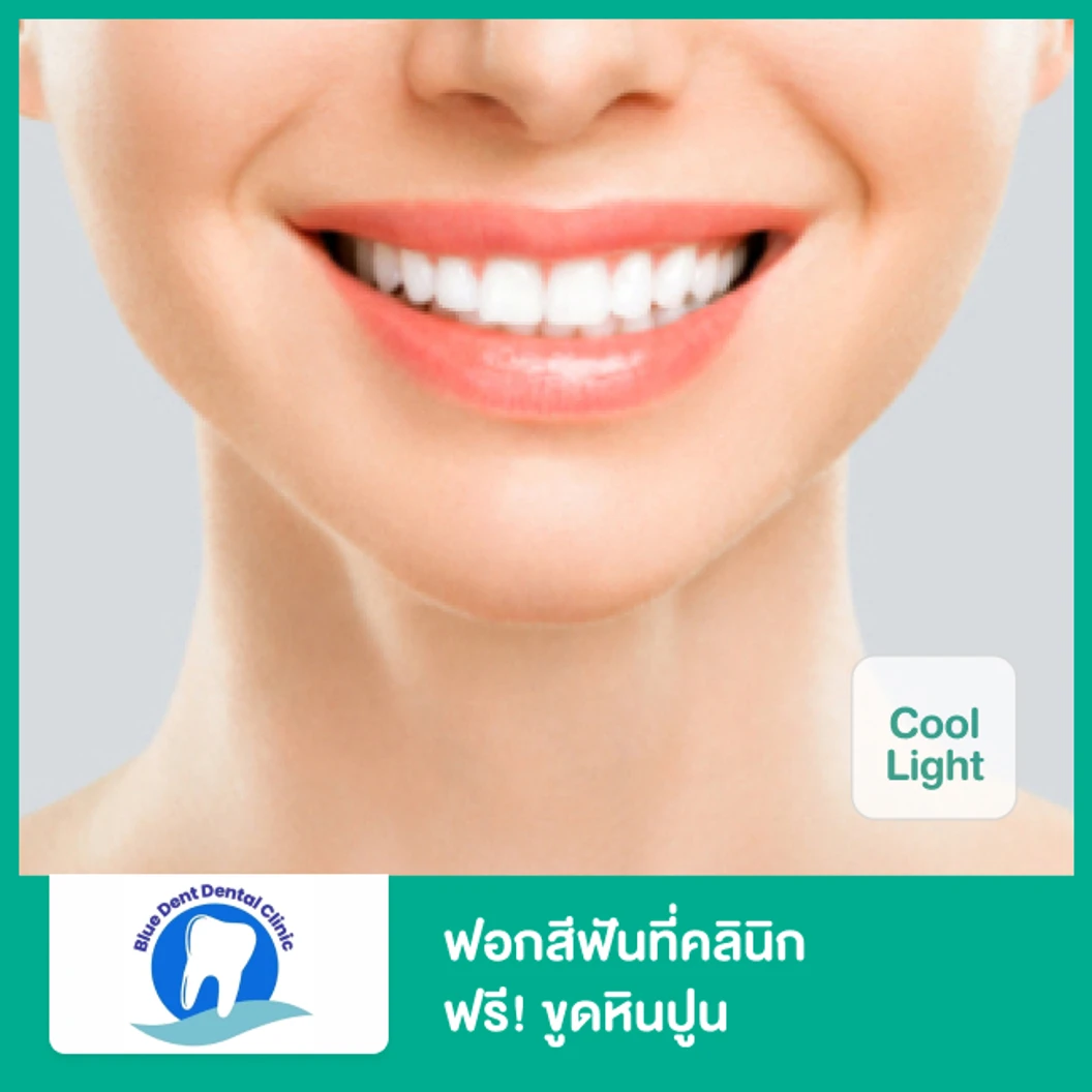 ฟอกสีฟันที่คลินิก ด้วยระบบ Cool Light ฟรี! ขูดหินปูน 1 ครั้ง