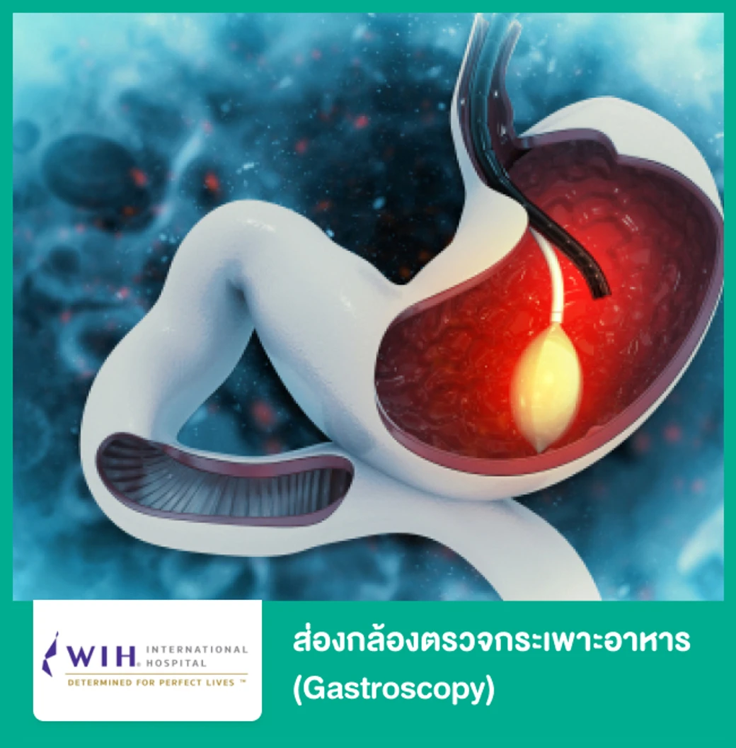 ส่องกล้องตรวจกระเพาะอาหาร (Gastroscopy)