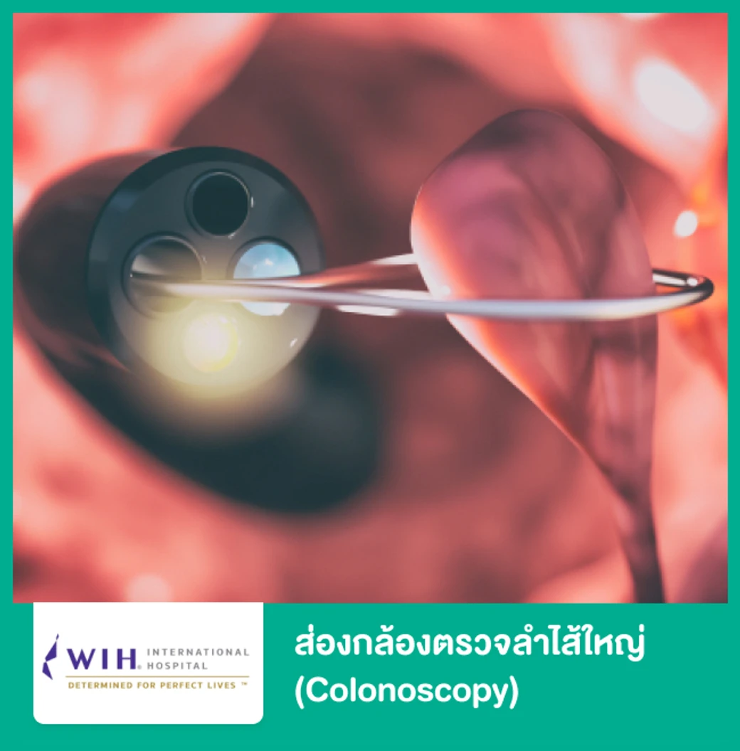 ส่องกล้องตรวจลำไส้ใหญ่ (Colonoscopy)