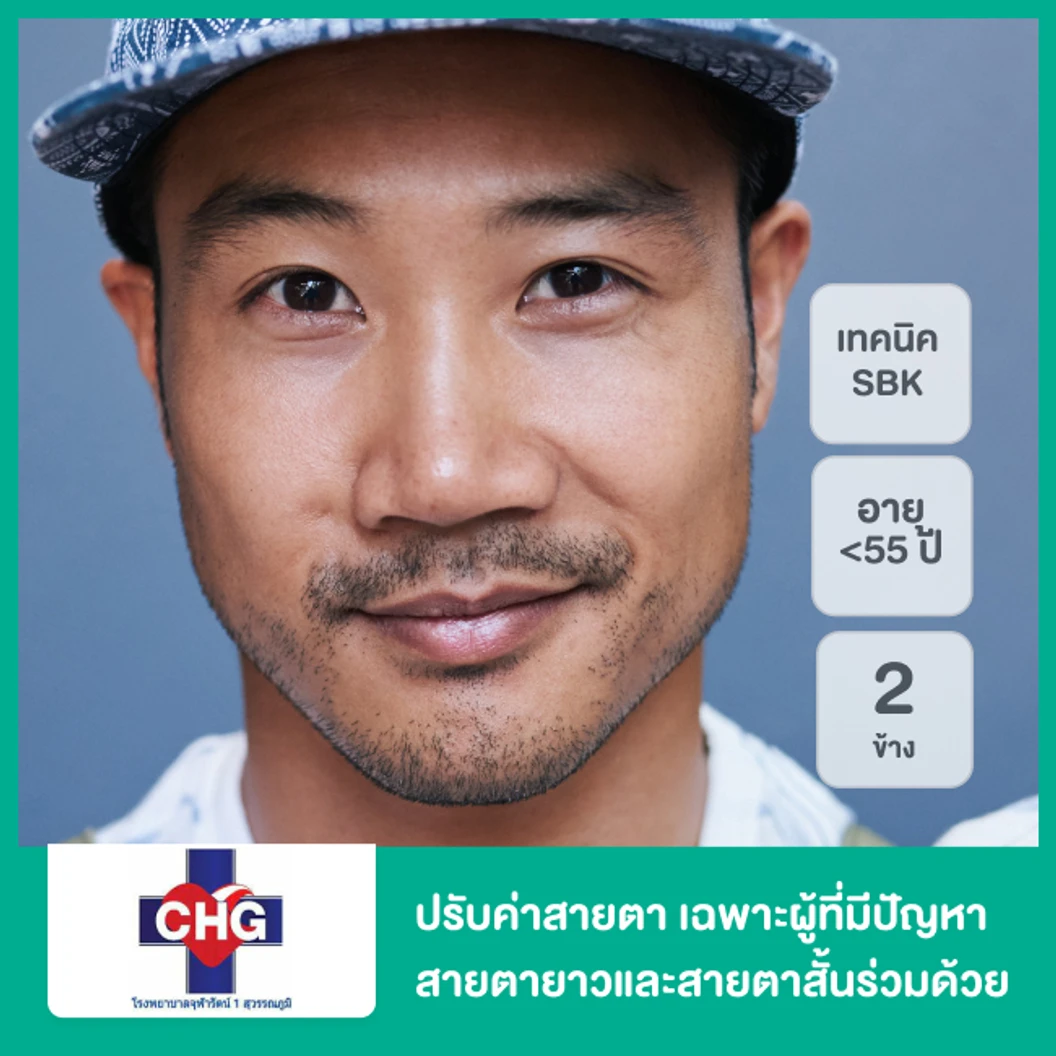 ปรับค่าสายตา ด้วยการทำ SBK LASIK วิธี Monovision สำหรับตา 2 ข้าง เฉพาะผู้ที่มีปัญหาสายตายาวและสายตาสั้นร่วมด้วย อายุไม่เกิน 55 ปี