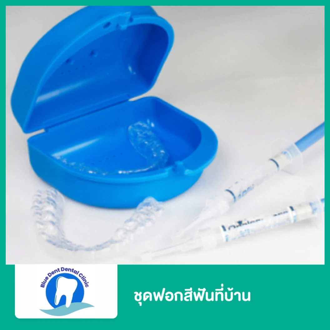 ชุดฟอกสีฟันที่บ้าน