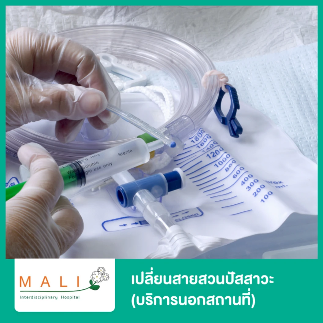 บริการใส่สายให้อาหาร หรือ เปลี่ยนสายสวนปัสสาวะ (บริการนอกสถานที่)