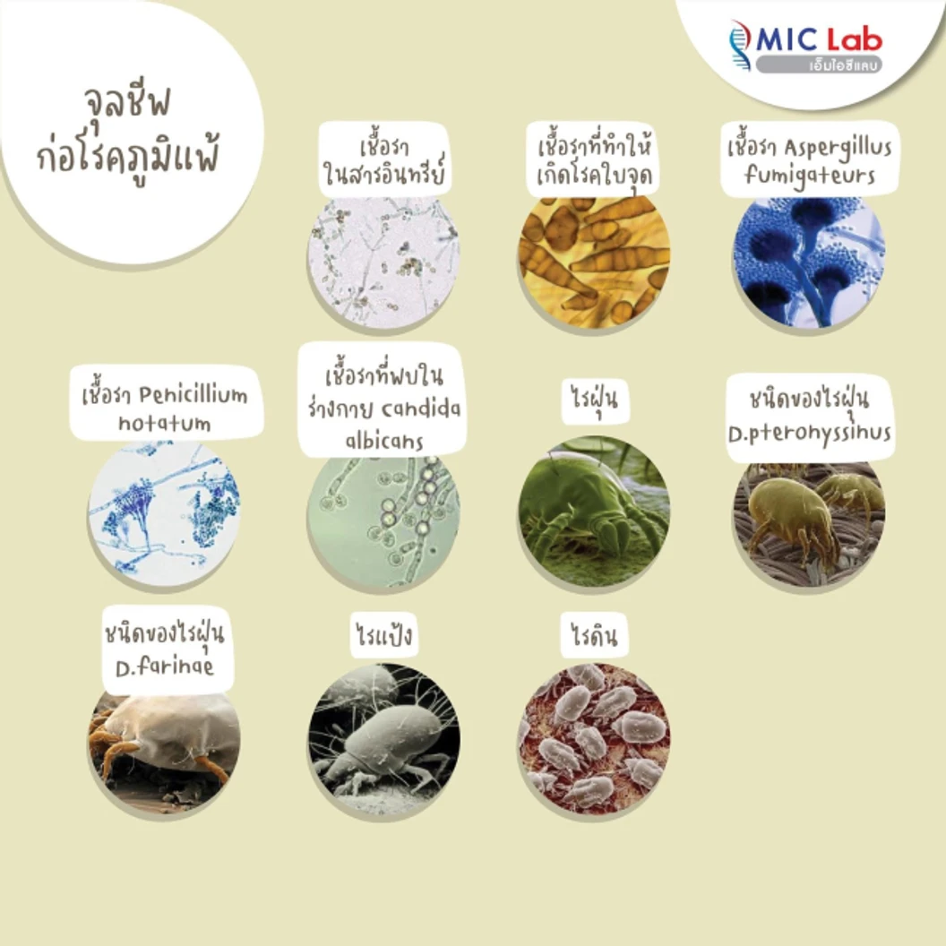 ตรวจหาสารก่อภูมิแพ้อาหารและสิ่งแวดล้อม 107 ชนิด (IgE Test) ด้วยวิธีเจาะเลือด