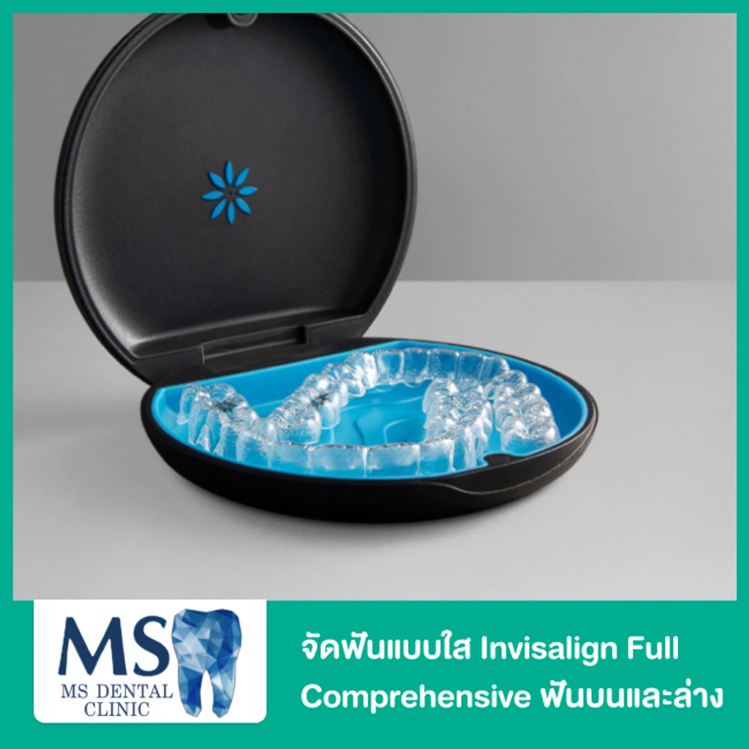จัดฟันแบบใส Invisalign Full Comprehensive ฟันบนและล่าง