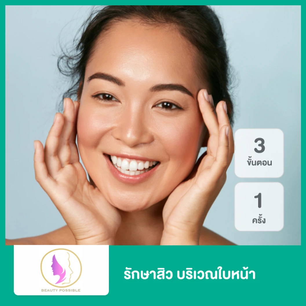 รักษาสิว 3 ขั้นตอน บริเวณใบหน้า 1 ครั้ง