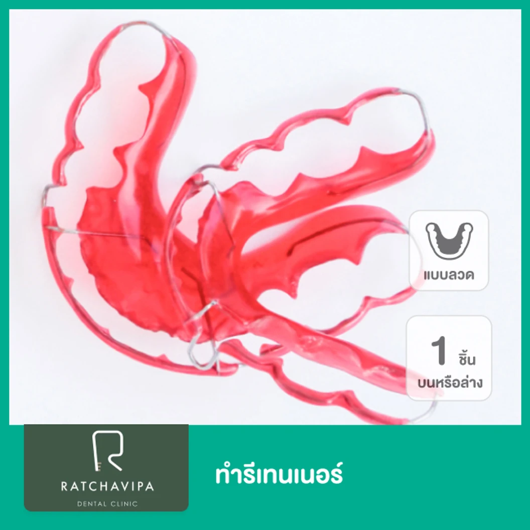 ทำรีเทนเนอร์แบบลวด 1 ชิ้น ฟันบนหรือล่าง