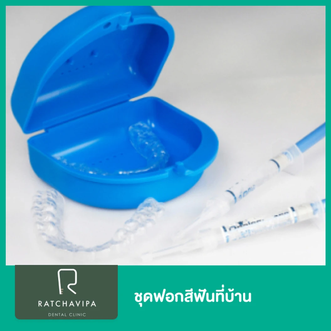 ชุดฟอกสีฟันที่บ้าน