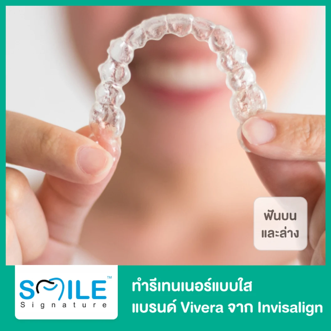 ทำรีเทนเนอร์แบบใส แบรนด์ Vivera จาก Invisalign ฟันบนและล่าง 3 คู่