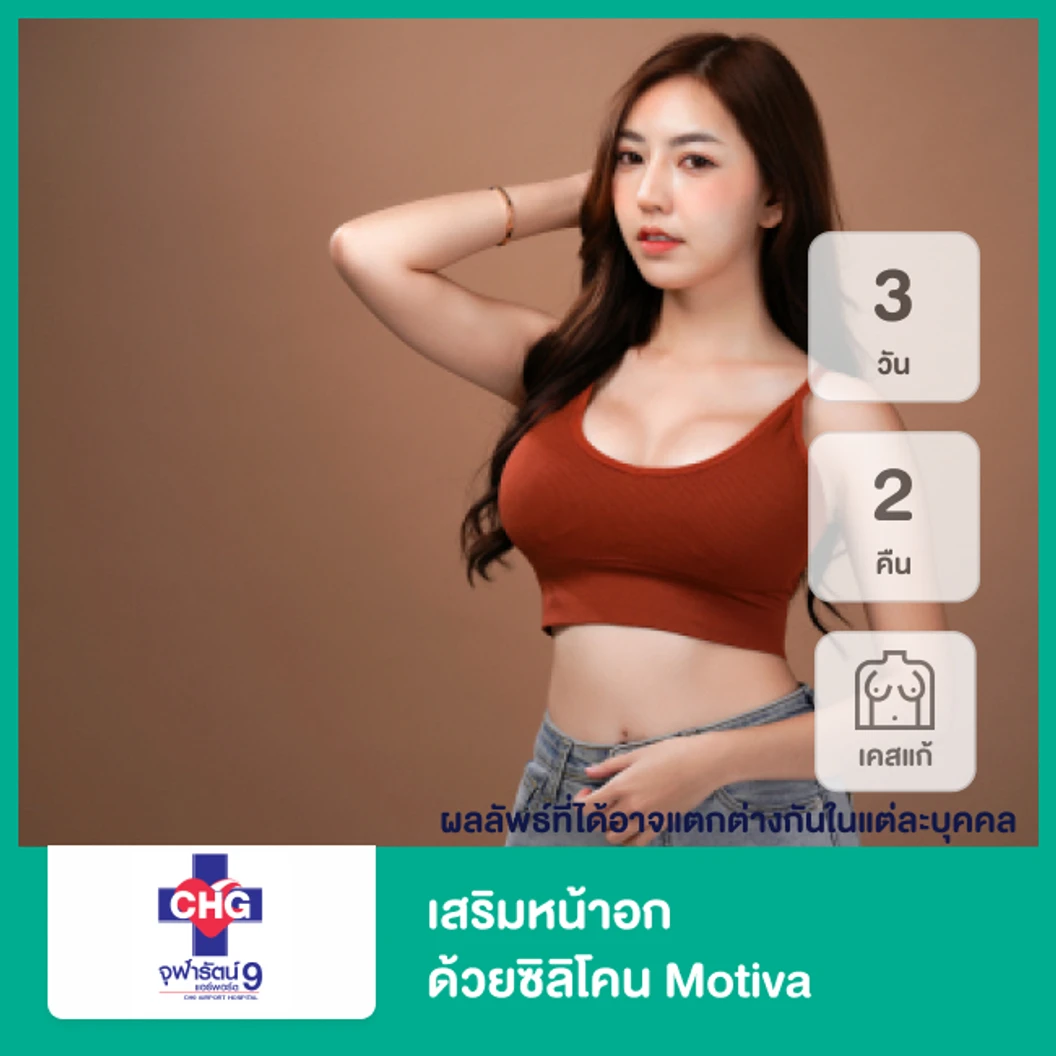 เสริมหน้าอก ด้วยซิลิโคน Motiva สำหรับเคสแก้ นอน รพ. 3 วัน 2 คืน