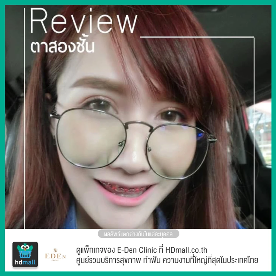 ทำตาสองชั้น แบบกรีดยาว สำหรับเคสทำครั้งแรก 1 ครั้ง