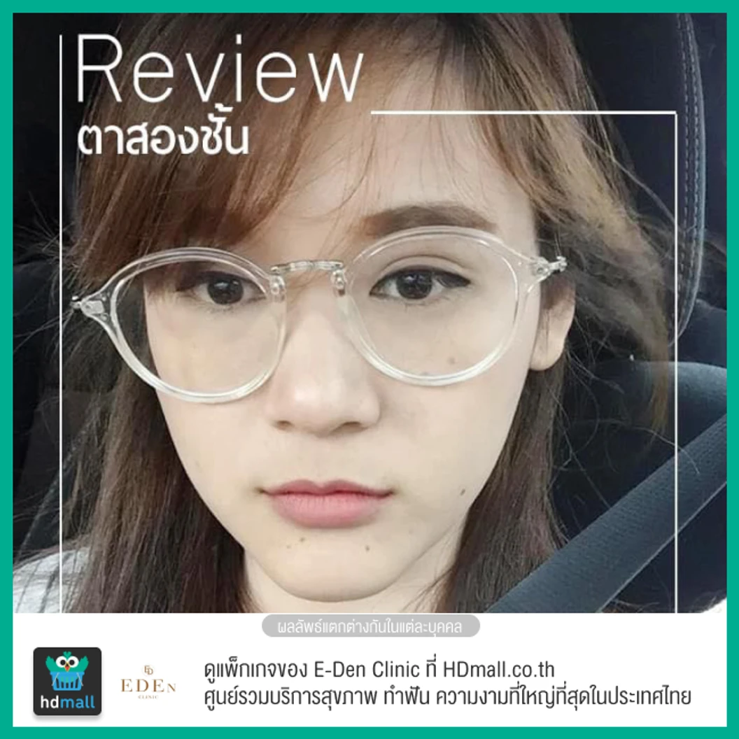 ทำตาสองชั้น แบบกรีดยาว สำหรับเคสทำครั้งแรก 1 ครั้ง