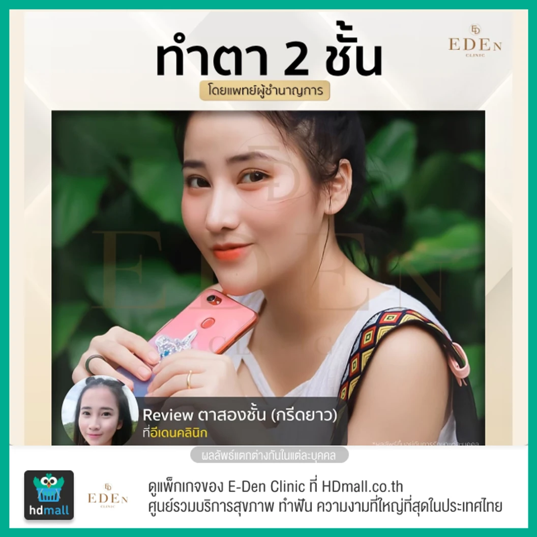 ทำตาสองชั้น แบบกรีดยาว สำหรับเคสทำครั้งแรก 1 ครั้ง