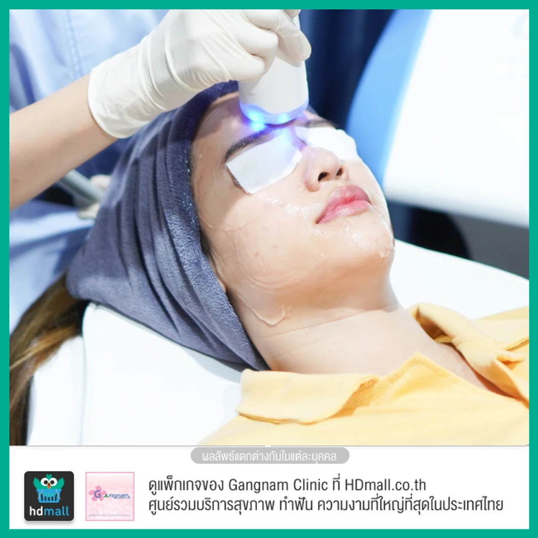 ทำทรีตเมนต์ New Pora Cool เติมวิตามินผิว ให้ผิวแข็งแรง กระจ่างใส ชุ่มชื้น รูขุมขนดูเล็กลง 1 ครั้ง