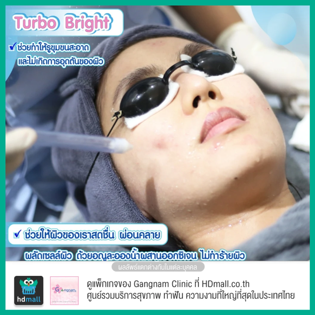 ทำทรีตเมนต์หน้า Turbo Bright ปรับสภาพผิวให้ดูกระจ่างใส 1 ครั้ง