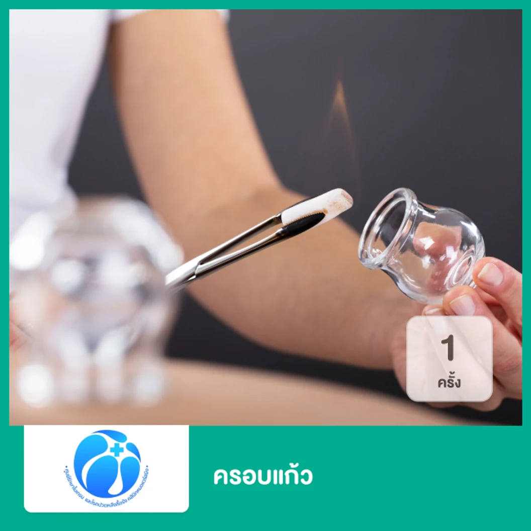 ครอบแก้ว 1 ครั้ง ที่ ศูนย์รักษาโรคปวดหลังเรื้อรัง หมอแวร์สมิงสหคลินิก
