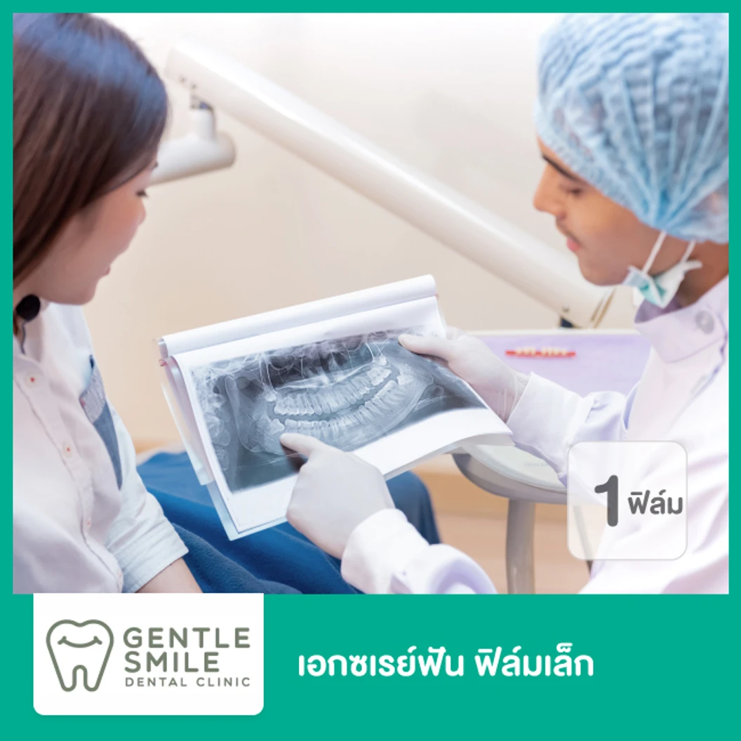 เอกซเรย์ฟัน 1 ฟิล์มเล็ก