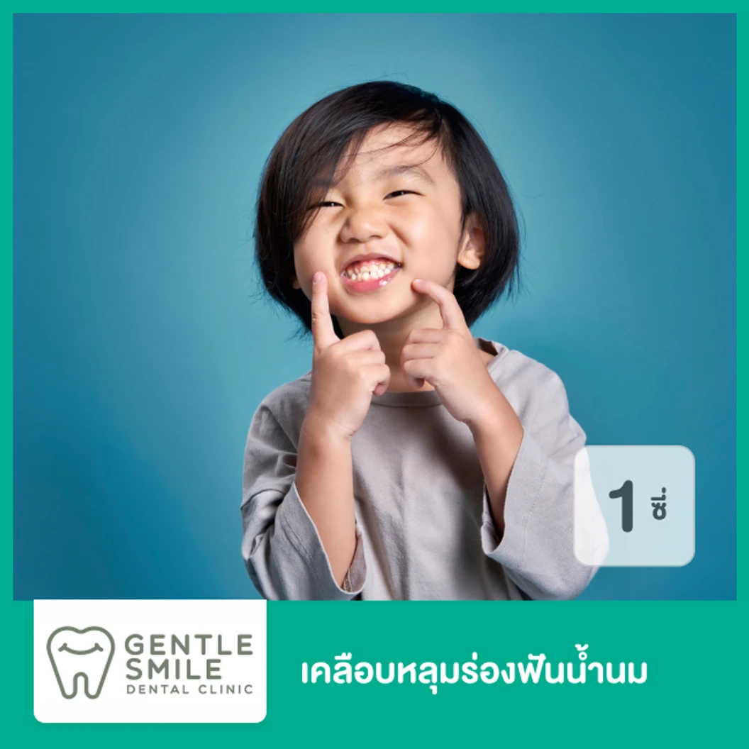 เคลือบหลุมร่องฟันน้ำนม 1 ซี่