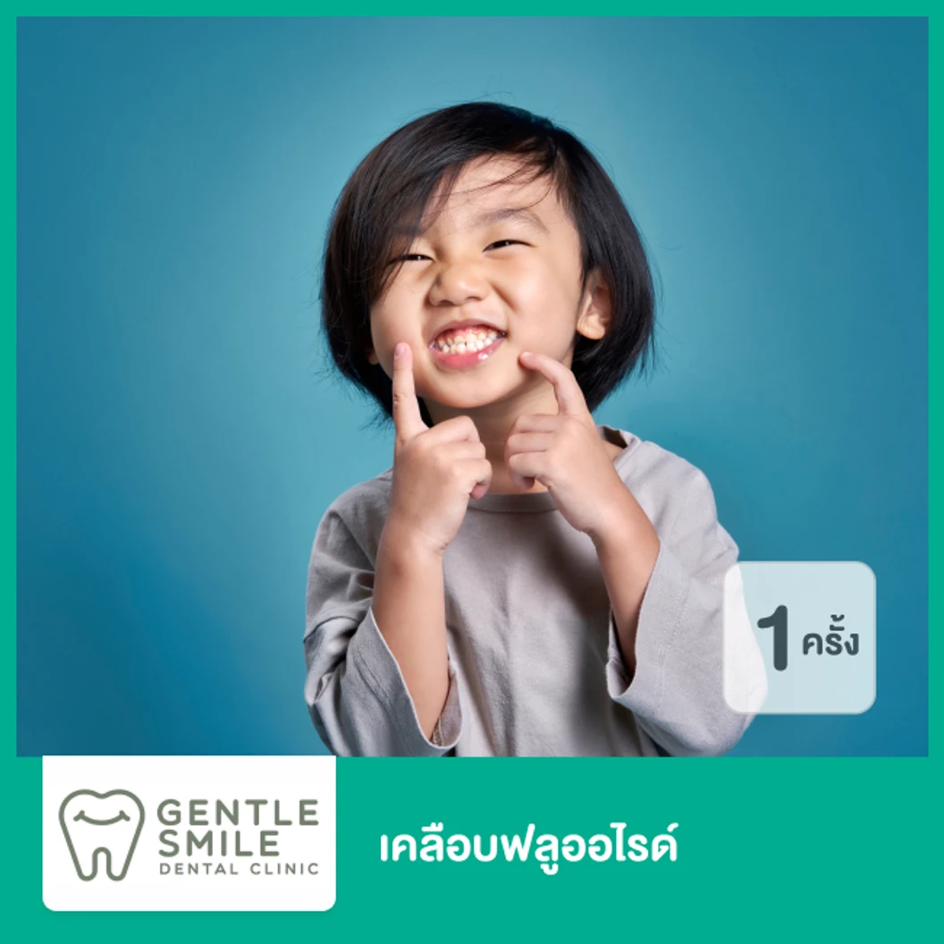 เคลือบฟลูออไรด์ 1 ครั้ง