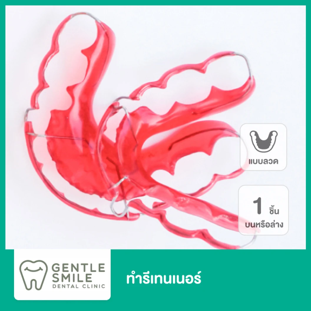 ทำรีเทนเนอร์แบบลวด 1 ชิ้น ฟันบนหรือล่าง