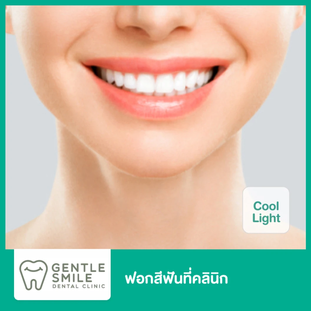 ฟอกสีฟันที่คลินิก ด้วยระบบ Cool Light