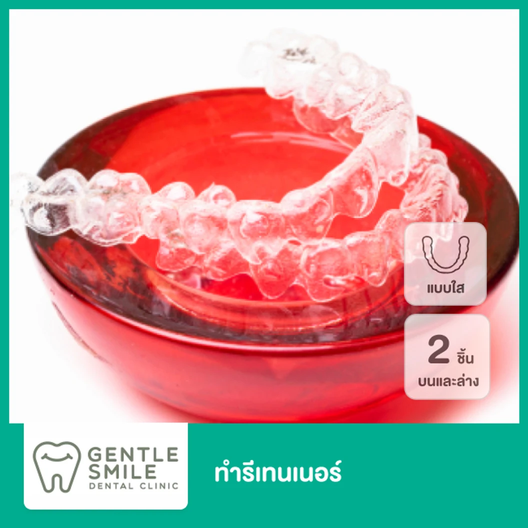 ทำรีเทนเนอร์แบบใส 2 ชิ้น ฟันบนและล่าง