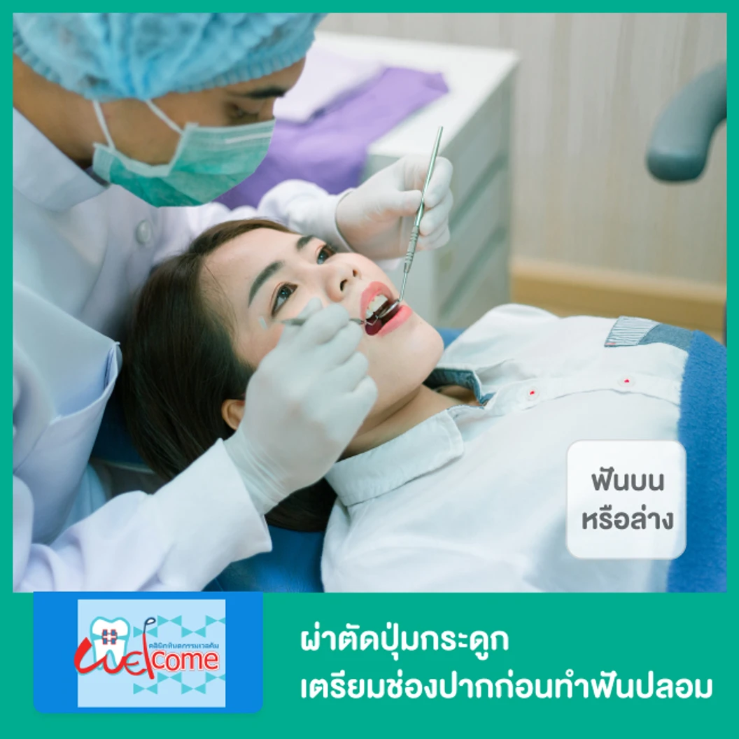 ผ่าตัดปุ่มกระดูก เตรียมช่องปากก่อนทำฟันปลอม สำหรับฟันบนหรือล่าง