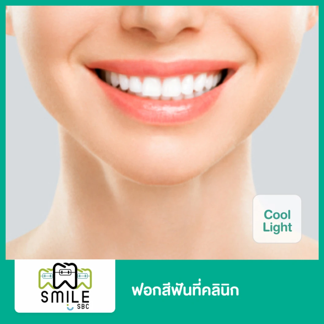 ฟอกสีฟันที่คลินิก ด้วยระบบ Cool Light