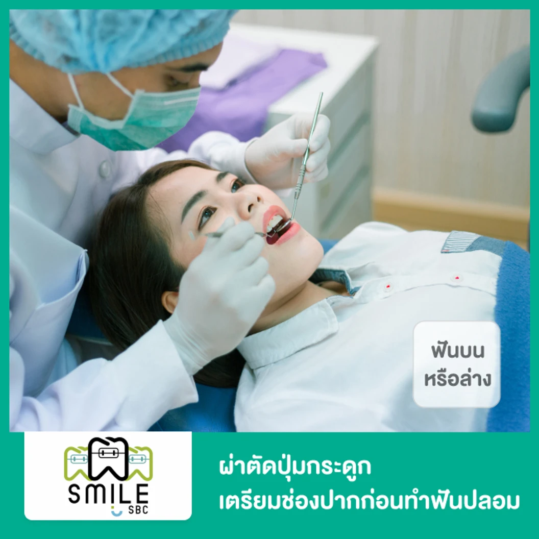 ผ่าตัดปุ่มกระดูก เตรียมช่องปากก่อนทำฟันปลอม สำหรับฟันบนหรือล่าง