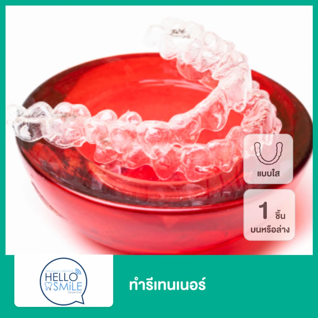 ทำรีเทนเนอร์แบบใส 1 ชิ้น ฟันบนหรือล่าง