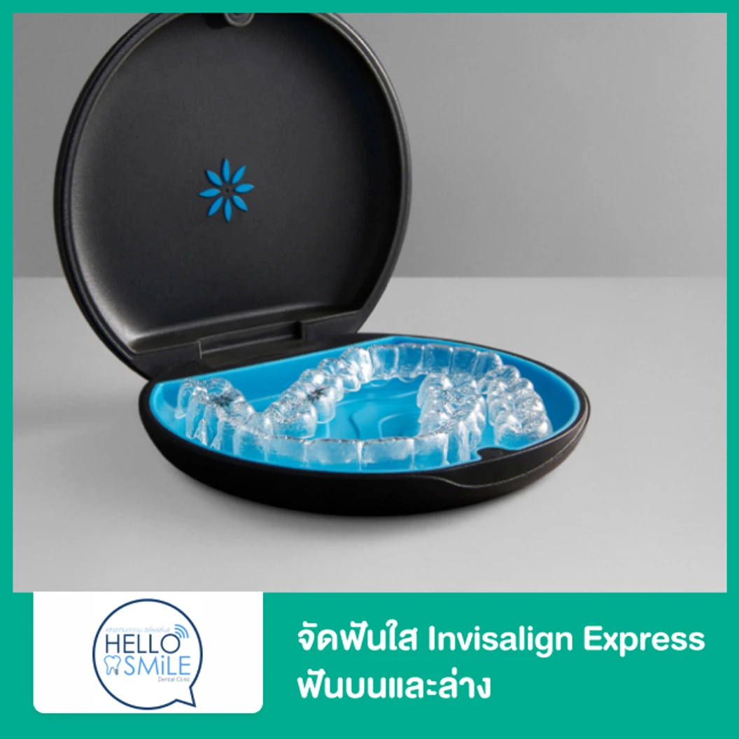 จัดฟันใส Invisalign Express ฟันบนและล่าง
