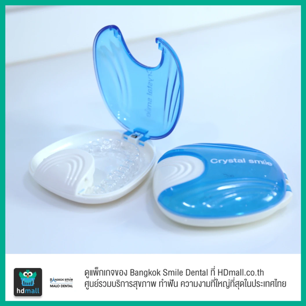 คอร์สจัดฟันแบบใส Crystal Smile Moderate ฟันบนและล่าง เครื่องมือไม่เกิน 20 ชิ้น