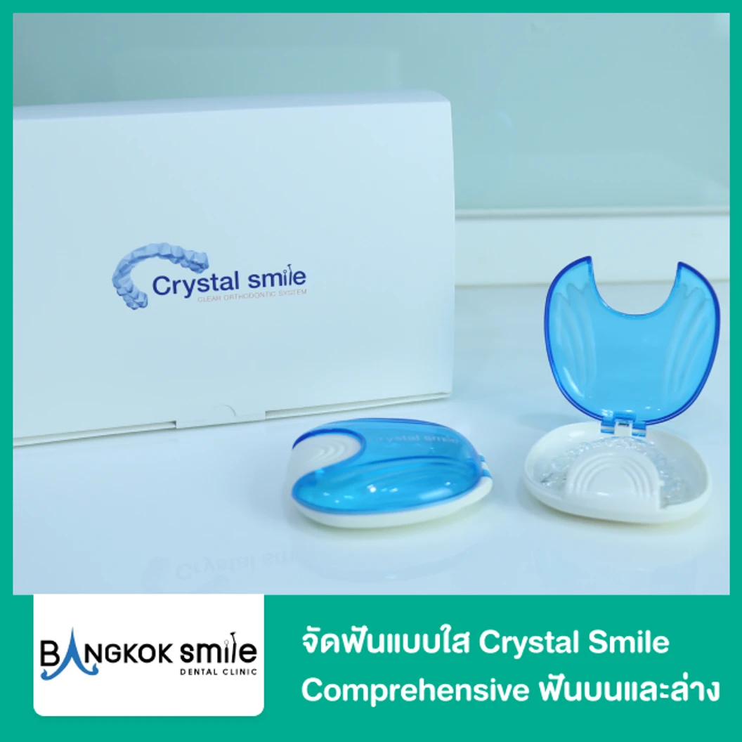 คอร์สจัดฟันแบบใส Crystal Smile Comprehensive ฟันบนและล่าง เครื่องมือ 20 ชิ้นขึ้นไป