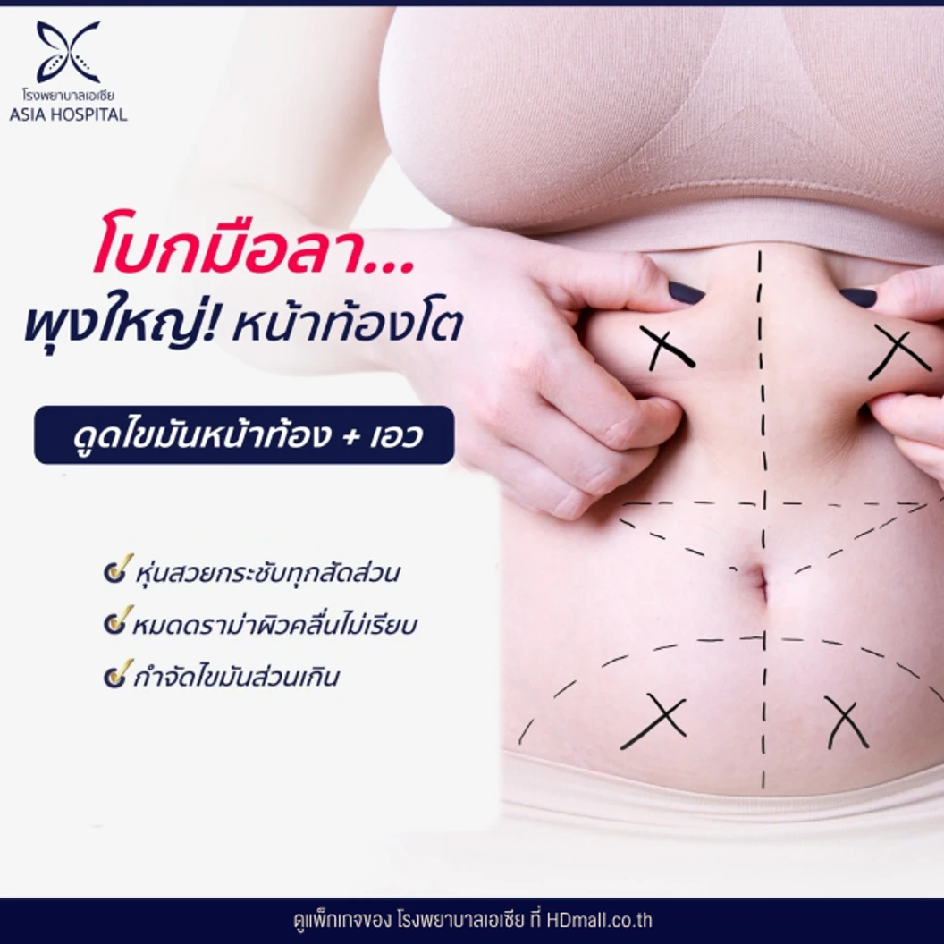 ดูดไขมันหน้าท้องและเอว 1 ครั้ง