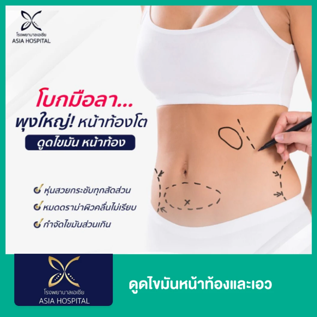 ดูดไขมันหน้าท้องและเอว 1 ครั้ง