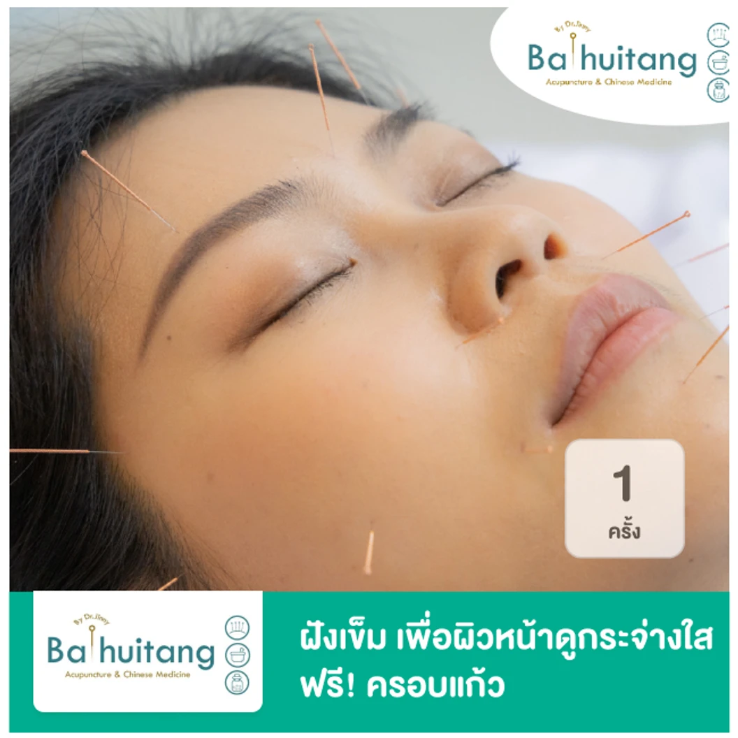 ฝังเข็ม เพื่อผิวหน้าดูกระจ่างใส ฟรี! ครอบแก้ว 1 ครั้ง