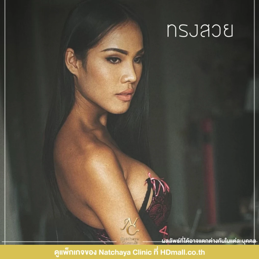 เสริมหน้าอก เทคนิควางซิลิโคนใต้กล้ามเนื้อ ด้วยซิลิโคน Mentor อเมริกา เพิ่มความมั่นใจในขนาดหน้าอก