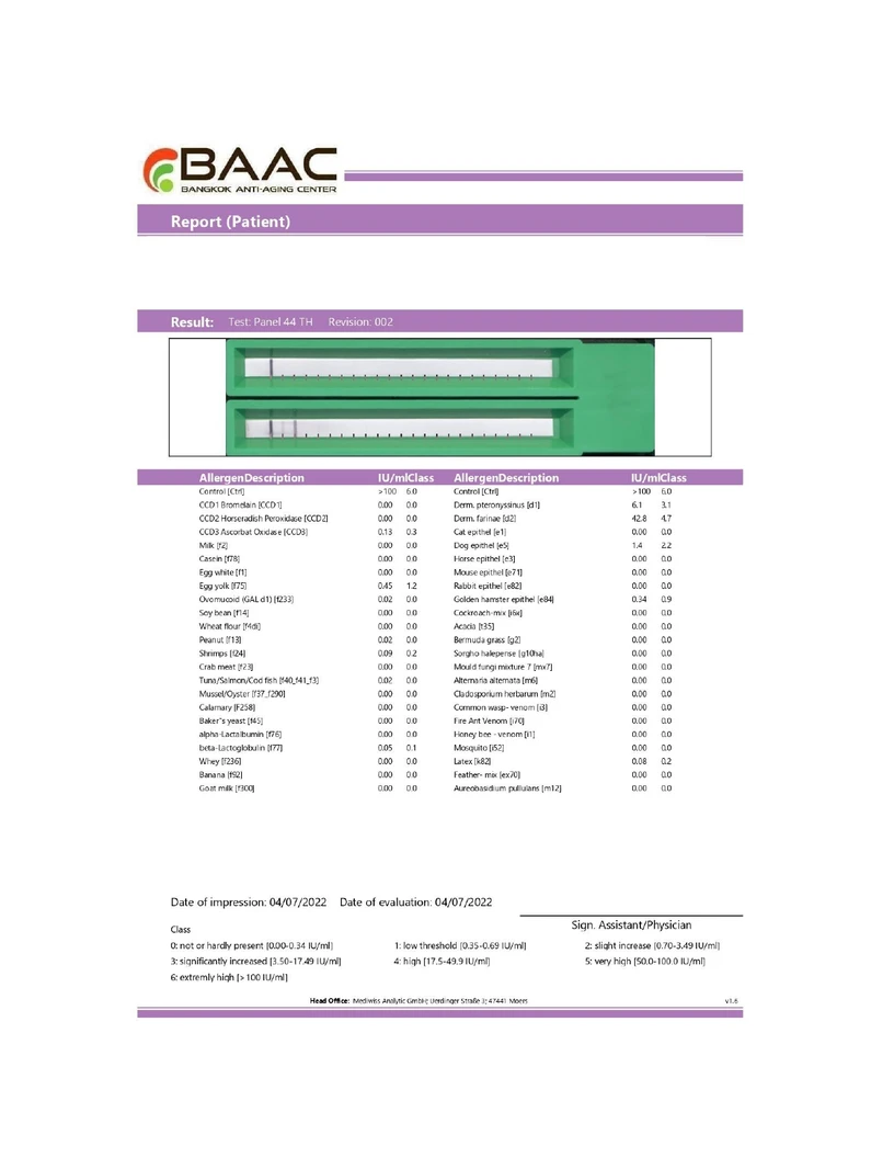 ตรวจภูมิแพ้อาหารเฉียบพลัน และสารก่อภูมิแพ้ในอากาศ 44 รายการ Allergen-Specific Immunoglobulin E (IgE) ด้วยวิธีเจาะเลือด