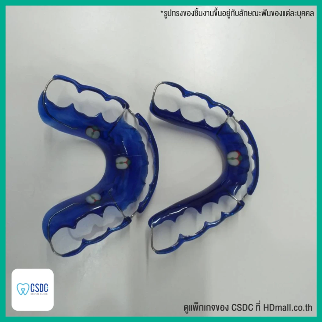 ทำรีเทนเนอร์แบบลวด 1 ชิ้น ฟันบนหรือล่าง