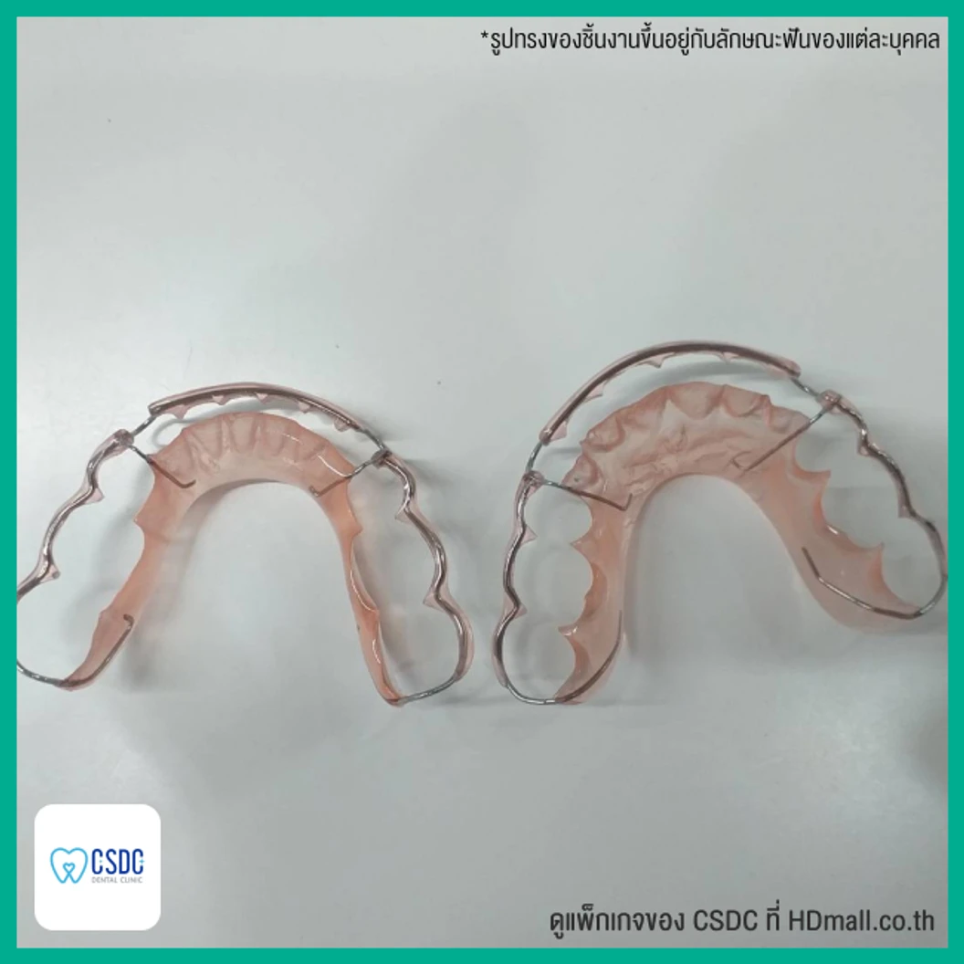 ทำรีเทนเนอร์แบบลวด 1 ชิ้น ฟันบนหรือล่าง