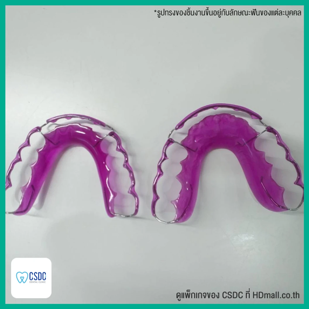 ทำรีเทนเนอร์แบบลวด 1 ชิ้น ฟันบนหรือล่าง