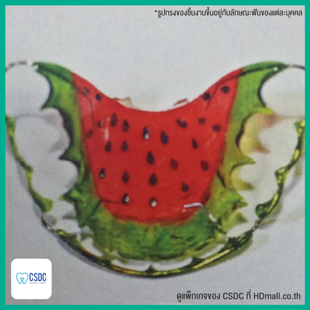 ทำรีเทนเนอร์แบบลวด 1 ชิ้น ฟันบนหรือล่าง