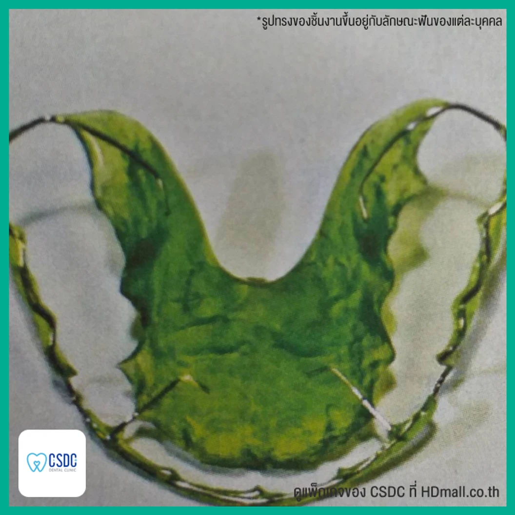 ทำรีเทนเนอร์แบบลวด 1 ชิ้น ฟันบนหรือล่าง