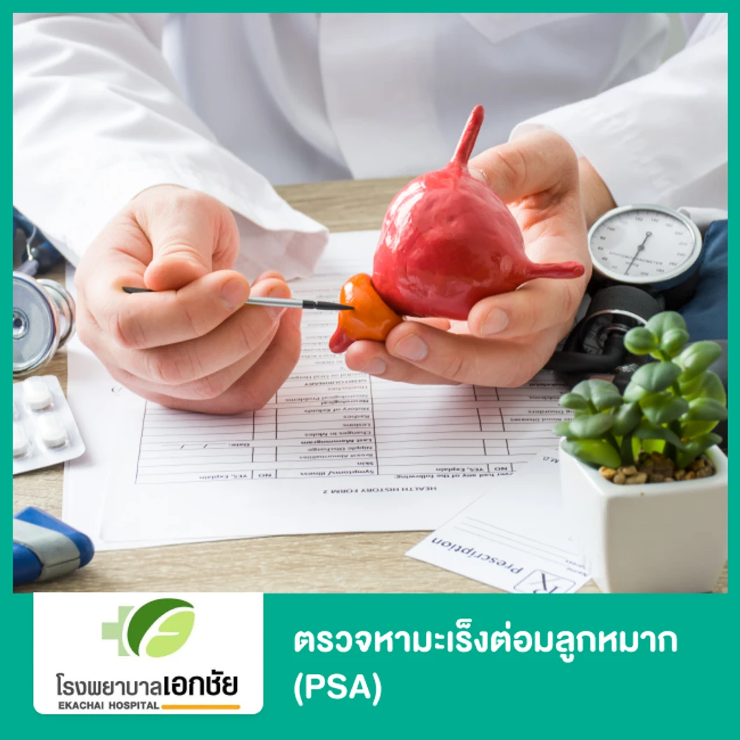 ตรวจหามะเร็งต่อมลูกหมาก (PSA)
