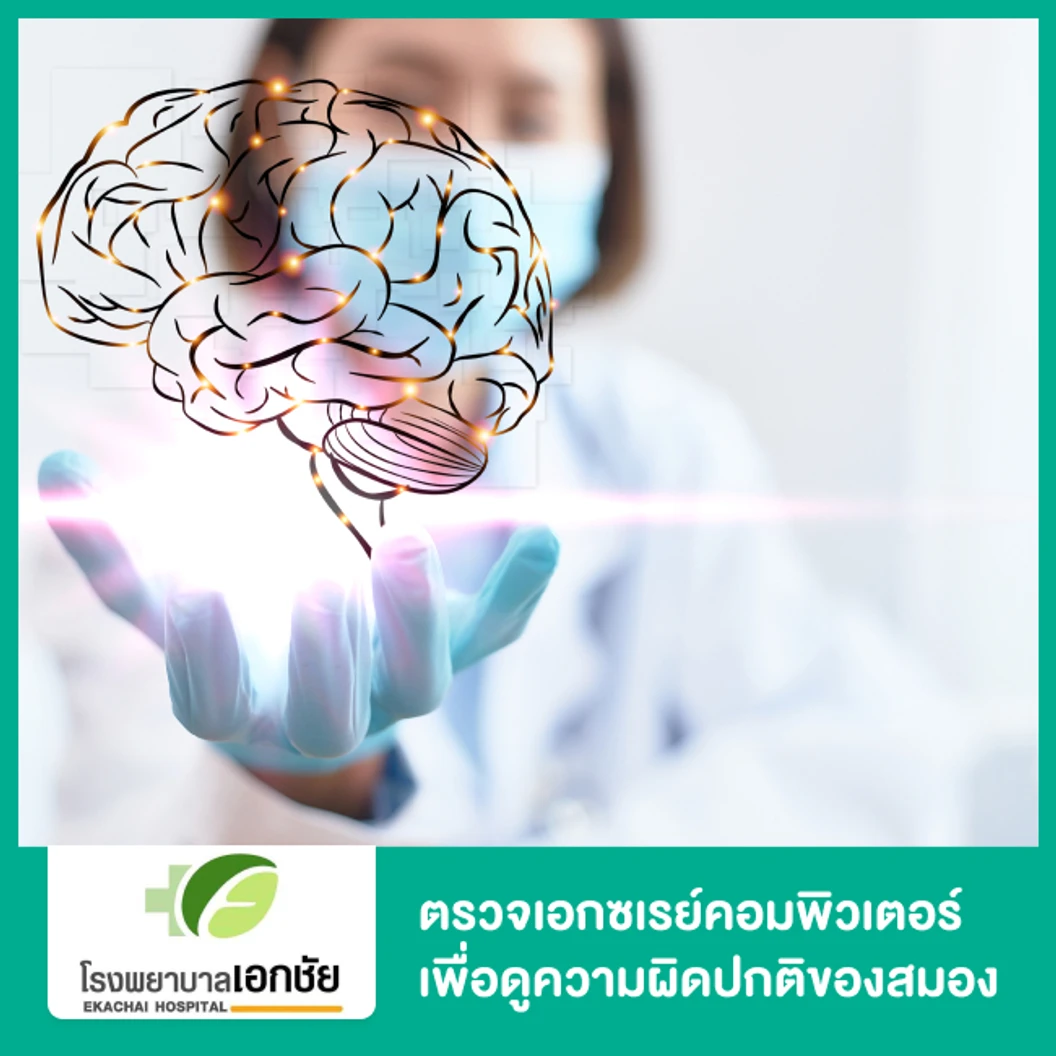 ตรวจเอกซเรย์คอมพิวเตอร์ เพื่อดูความผิดปกติของสมอง (CT Scan)