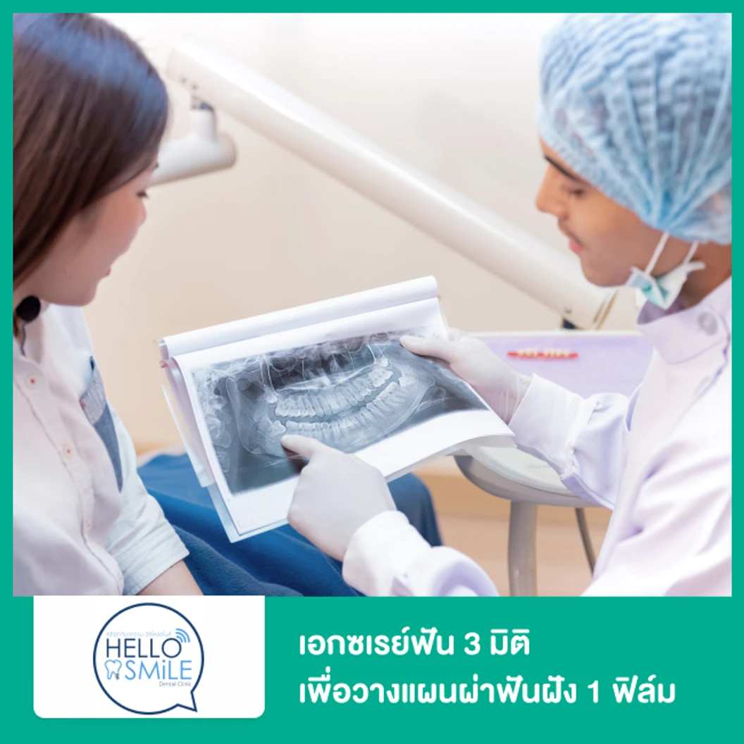 เอกซเรย์ฟัน 3 มิติ เพื่อวางแผนผ่าฟันฝัง 1 ฟิล์ม