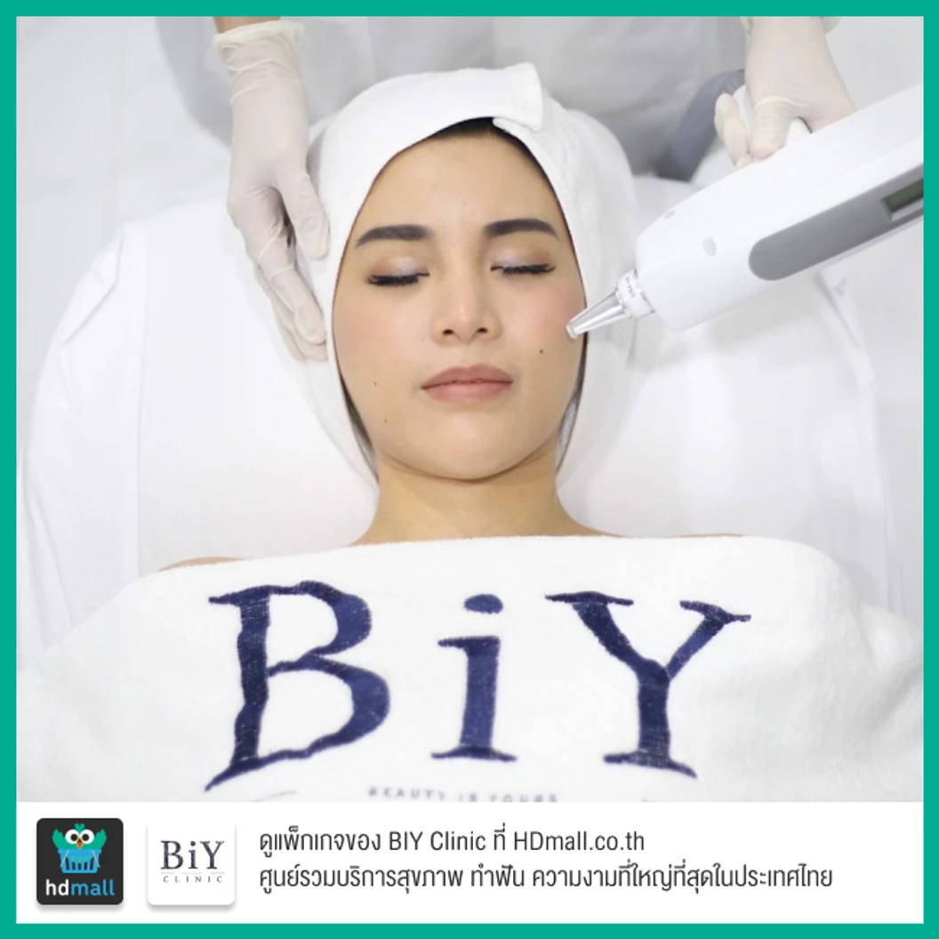 คอร์สเลเซอร์ Q-Switch ปรับผิวหน้ากระจ่างใส ลดเลือนฝ้า กระ 3 ครั้ง