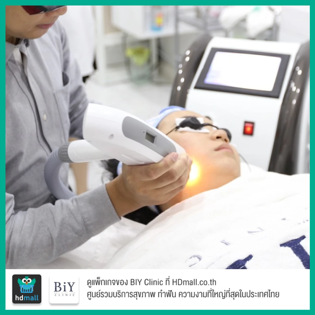 คอร์สเลเซอร์ Q-Switch ปรับผิวหน้ากระจ่างใส ลดเลือนฝ้า กระ 3 ครั้ง