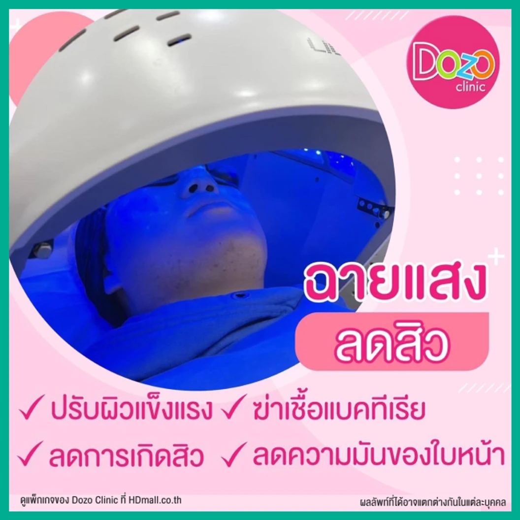 Acne Treatment รักษาสิว บริเวณใบหน้า 5 ขั้นตอน 1 ครั้ง