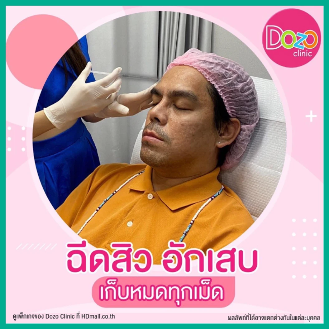 Acne Treatment รักษาสิว บริเวณใบหน้า 5 ขั้นตอน 1 ครั้ง